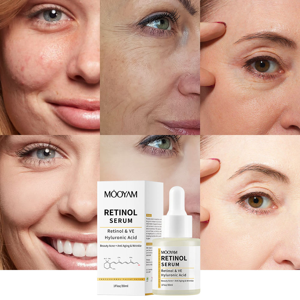 Siero al retinolo MOOYAM con vitamina E e acido ialuronico